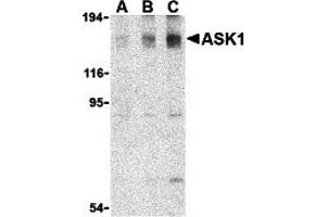 Western Blotting (WB) image for anti-Mitogen-Activated Protein Kinase Kinase Kinase 5 (MAP3K5) antibody (ABIN1030199) (ASK1 Antikörper)