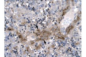 ZNF365 antibody was used for immunohistochemistry at a concentration of 4-8 ug/ml to stain Hepatocyte (arrows) in Human Liver. (ZNF365 Antikörper  (N-Term))