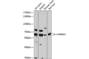 Western blot analysis of extracts of various cell lines, using CHRN antibody (ABIN6133178, ABIN6138575, ABIN6138576 and ABIN6218768) at 1:1000 dilution. (CHRNA3 Antikörper  (AA 32-240))