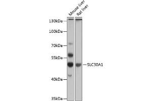 Western blot analysis of extracts of various cell lines, using SLC30 antibody (2533) at 1:1000 dilution. (SLC30A1 Antikörper  (AA 328-507))