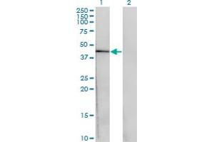 Western Blot analysis of CENPJ expression in transfected 293T cell line by CENPJ monoclonal antibody (M02), clone 1A5.