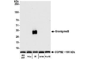 Western Blotting (WB) image for anti-Granzyme B (GZMB) (AA 19-247) antibody (ABIN7449554) (Rekombinanter GZMB Antikörper  (AA 19-247))