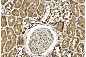 Immunohistochemical analysis of paraffin-embedded Human kidney section using Pink1 am1893b.