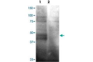 Western blot analysis of HEK293 cells over-expressing SLC2A1 (Lane 1) or a nono-specific control receptor (Lane 2) using SLC2A1 polyclonal antibody  at 1:200 dilution. (GLUT1 Antikörper)