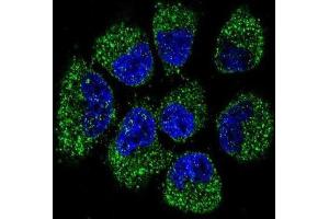 Immunofluorescence (IF) image for anti-Tumor Necrosis Factor Receptor Superfamily, Member 11b (TNFRSF11B) antibody (ABIN2997504) (Osteoprotegerin Antikörper)