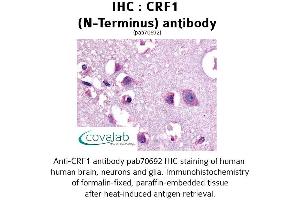Image no. 1 for anti-Corticotropin Releasing Hormone Receptor 1 (CRHR1) (Extracellular Domain), (N-Term) antibody (ABIN1733304)