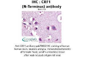 Image no. 1 for anti-Corticotropin Releasing Hormone Receptor 1 (CRHR1) (Extracellular Domain), (N-Term) antibody (ABIN1733304) (CRHR1 Antikörper  (Extracellular Domain, N-Term))