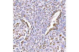 IHC analysis of SUCLG1 using anti-SUCLG1 antibody (ABIN7600906). (SUCLG1 Antikörper  (AA 25-346))
