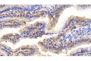 Detection of FABP2 in Bovine Small intestine Tissue using Polyclonal Antibody to Fatty Acid Binding Protein 2, Intestinal (FABP2) (FABP2 Antikörper  (AA 2-128))