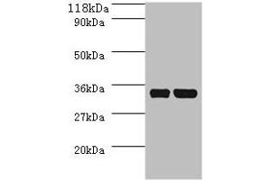 Western blot All lanes: dcyD antibody at 2 μg/mL + DH5a whole cell lysate Secondary Goat polyclonal to rabbit IgG at 1/10000 dilution Predicted band size: 35 kDa Observed band size: 35 kDa (DcyD Antikörper  (AA 2-328))