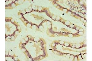 Immunohistochemistry of paraffin-embedded human small intestine tissue using ABIN7156912 at dilution of 1:100 (IL-37 Antikörper  (AA 1-218))