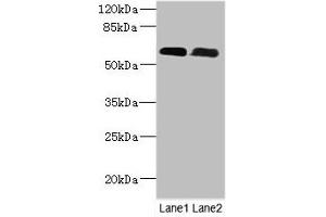 Western Blot All lanes: PNPLA1 antibody at 12 μg/mL Lane 1: Mouse spleen tissue Lane 2: Mouse skeletal muscle tissue Secondary Goat polyclonal to rabbit IgG at 1/10000 dilution Predicted band size: 58, 48, 49 kDa Observed band size: 58 kDa (PNPLA1 Antikörper  (AA 101-300))