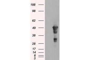 Image no. 1 for anti-Glial Fibrillary Acidic Protein (GFAP) antibody (ABIN1498442) (GFAP Antikörper)