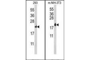 Western blot analysis of RPL18A Antibody (C-term) Cat. (RPL18A Antikörper  (C-Term))