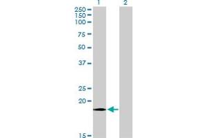 Western Blot analysis of COX4I1 expression in transfected 293T cell line by COX4I1 monoclonal antibody (M08), clone 4A10.