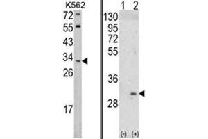 (LEFT) Western blot analysis of ITM2A Antibody (N-term) in K562 cell line lysates (35ug/lane).