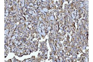 IHC analysis of CD147/Emmprin using anti-CD147/Emmprin antibody (ABIN7599999). (CD147 Antikörper  (AA 138-323))