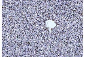 IHC analysis of Cathepsin B/CTSB using anti-Cathepsin B/CTSB antibody (ABIN7601692). (Cathepsin B Antikörper  (AA 42-339))