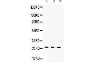 Western blot analysis of DDAH2 expression in rat lung extract ( Lane 1), mouse lung extract ( Lane 2) and human placenta extract ( Lane 3). (DDAH2 Antikörper  (C-Term))