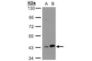 WB Image Sample(30 ug whole cell lysate) A:H1299 B:HeLa S3, 10% SDS PAGE antibody diluted at 1:3000 (MAPKAP Kinase 3 Antikörper)