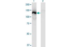 Western Blot analysis of SSH1 expression in transfected 293T cell line by SSH1 monoclonal antibody (M12), clone 2F9. (SSH1 Antikörper  (AA 752-849))