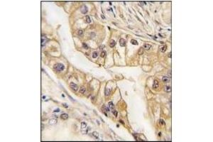 Immunohistochemistry (IHC) image for anti-EPH Receptor B2 (EPHB2) antibody (ABIN356401) (EPH Receptor B2 Antikörper)