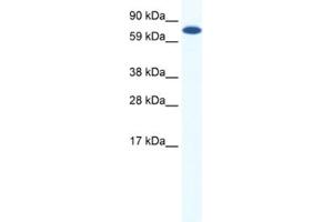 Western Blotting (WB) image for anti-Core-binding Factor, Runt Domain, alpha Subunit 2, Translocated To, 2 (CBFA2T2) antibody (ABIN2461546) (CBFA2T2 Antikörper)