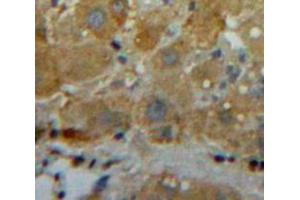 Used in DAB staining on fromalin fixed paraffin-embedded Liver tissue (Zinc Finger Protein CONSTANS-LIKE 9-Like (COL9) (AA 1572-1754) Antikörper)