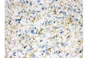 Anti- TH Picoband antibody,IHC(P) IHC(P): Rat Brain Tissue (TH Antikörper  (Middle Region))