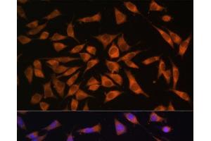 Immunofluorescence analysis of L929 cells using PMM2 Polyclonal Antibody at dilution of 1:100. (PMM2 Antikörper)