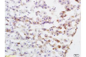 Formalin-fixed and paraffin embedded rat liver tissue labeled with Anti caspase-8 subunit p18 Polyclonal Antibody, Unconjugated (ABIN1386778) at 1:200 followed by conjugation to the secondary antibody and DAB staining