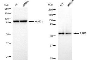 Western blotting analysis using PAK2 antibody (ABIN7799719). (Rekombinanter PAK2 Antikörper)