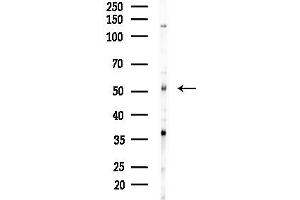 anti-gamma-aminobutyric Acid (GABA) A Receptor, gamma 2 (GABRG2) (N-Term) antibody