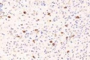 Immunohistochemistry analysis of paraffin-embedded mouse brain using RASGRP3 (ABIN7075376) at dilution of 1: 1000 (RASGRP3 Antikörper)