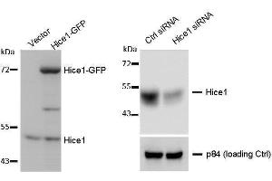 Western blot analysis of using a 7. (NYS48/HAUS8 Antikörper)