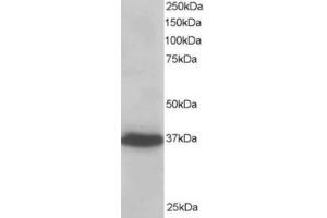 Western Blotting (WB) image for anti-PDZ and LIM Domain 4 (PDLIM4) (C-Term) antibody (ABIN2466091) (PDLIM4 Antikörper  (C-Term))