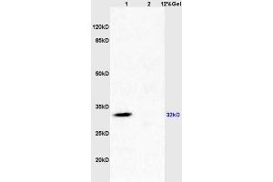 Lane 1: mouse brain lysates Lane 2: mouse kidney lysates probed with Anti SDHB Polyclonal Antibody, Unconjugated (ABIN719411) at 1:200 in 4 °C. (SDHB Antikörper  (AA 201-280))