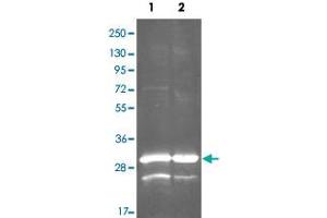 Western Blot analysis by gdh polyclonal antibody  at 1:3000. (Glutamate Dehydrogenase (GDH) Antikörper)