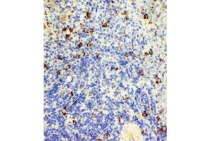 Immunohistochemistry (IHC) image for anti-TNF Receptor Superfamily, Member 6 (FAS) (AA 87-109), (N-Term) antibody (ABIN3044338)