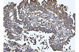 IHC analysis of Integrin linked ILK using anti-Integrin linked ILK antibody (ABIN7602632).