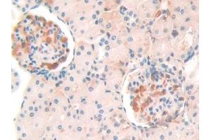 Detection of SERPINA10 in Rat Kidney Tissue using Polyclonal Antibody to Serpin A10 (SERPINA10)