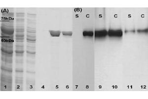 SDS–PAGE and Western blots that confirm LLO production by three of the constructed strains. (LLO Antikörper)