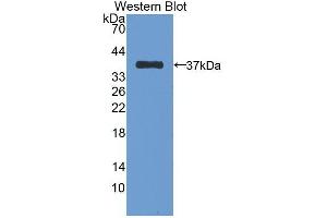 Western Blotting (WB) image for anti-Cadherin 1, Type 1, E-Cadherin (Epithelial) (CDH1) (AA 373-621) antibody (ABIN7425608)