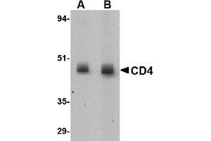 Western Blotting (WB) image for anti-CD4 (CD4) (N-Term) antibody (ABIN492544) (CD4 Antikörper  (N-Term))