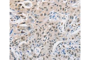 Immunohistochemistry (IHC) image for anti-Cell Division Cycle 27 Homolog (S. Cerevisiae) (CDC27) antibody (ABIN2427931) (CDC27 Antikörper)