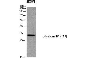 Western Blot (WB) analysis of SKOV3 using p-Histone H1 (T17) antibody. (Histone H1 Antikörper  (pThr17))