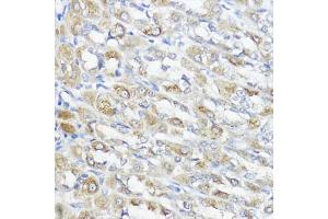 Immunohistochemistry of paraffin-embedded rat stomach using GPX2 antibody (ABIN7267435) at dilution of 1:100 (40x lens). (Glutathione Peroxidase 2 Antikörper  (AA 100-180))