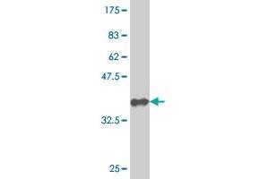 Western Blot detection against Immunogen (36. (Nucleostemin Antikörper  (AA 328-427))
