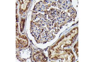 Immunohistochemistry of paraffin-embedded human kidney using Human IgM Rabbit mAb (ABIN7267845) at dilution of 1:100 (40x lens). (IGHM Antikörper)
