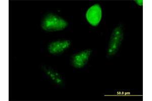 Immunofluorescence of monoclonal antibody to GCM1 on HeLa cell. (GCM1 Antikörper  (AA 108-166))